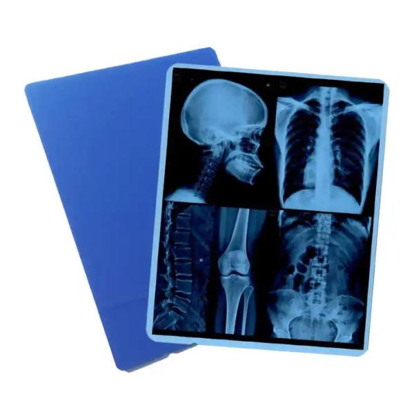Medical Image System Laser X Ray Dry Film For DR CR MRI X - Ray Printer With CE ISO