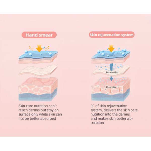 Non Invasive 60W Eyes Care Smooth Fine Lines Multi Level Radio Frequency Device
