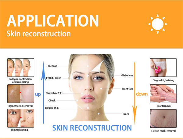 Воздушное охлаждение машины 30W лазера СО2 подмолаживания кожи частичное