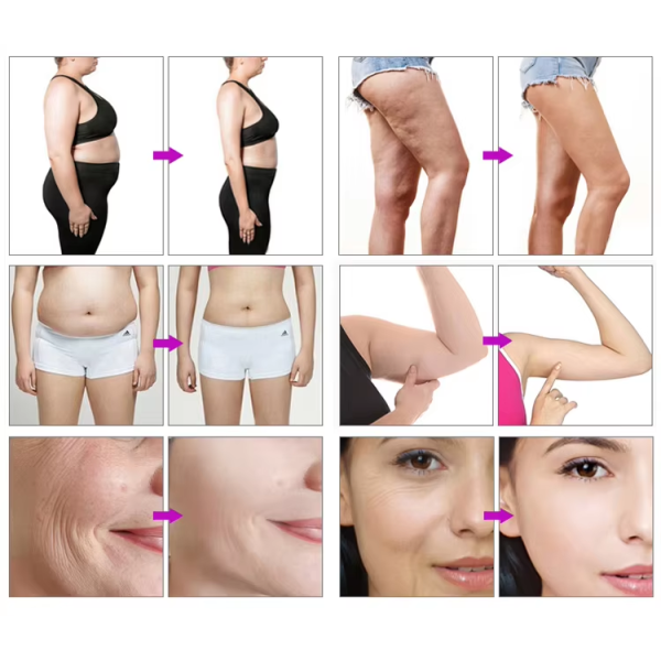 New Arrival Endermology Roller Beauty Equipment Vela Body Shaping Machine Infrared Vacuum Roller Massage Machine