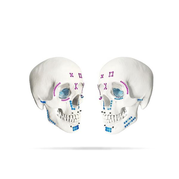 Maxillofacial Plates System Self Drilling Tapping Screws Custom Thickness