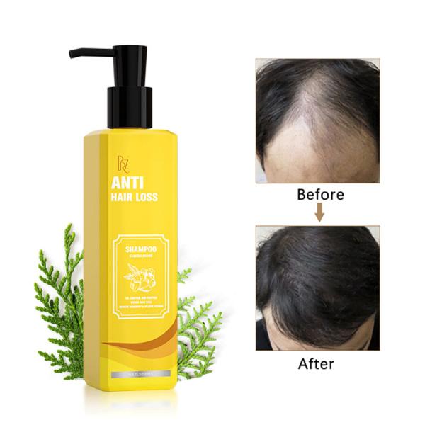 Stop Hair Loss Old Ginger Hair Growth Shampoo Anti Microbica Action
