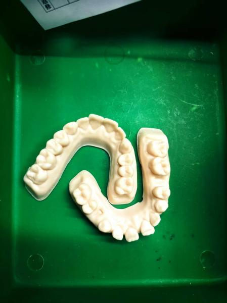 Versatile Uses​ Dental Model Resin Low Viscosity Clear Epoxy Resin Smooth Margins