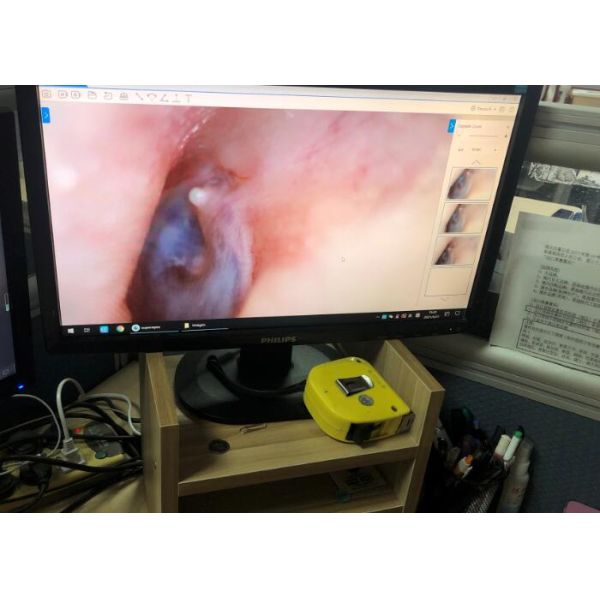 Андроид/камера Ios/Windows беспроводная Intraoral