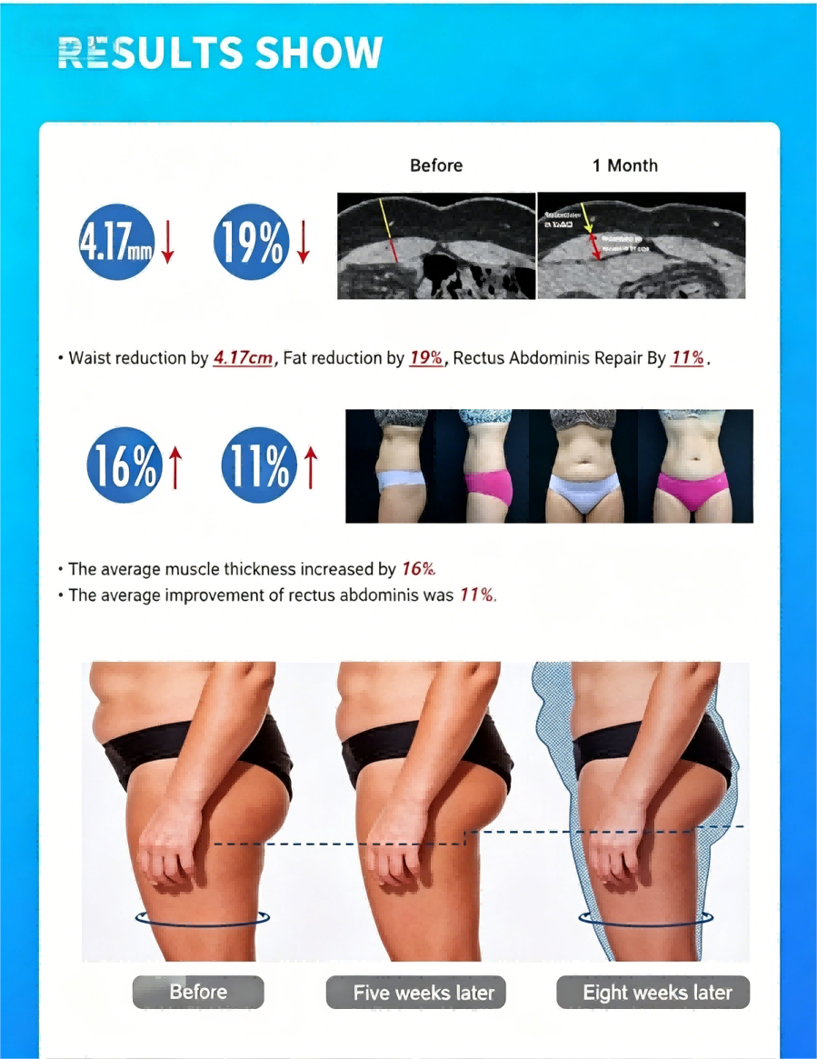 8D Inner Ball Roller Body Sculpting Machine For Lymphatic Drainage / Cellulite Reduction