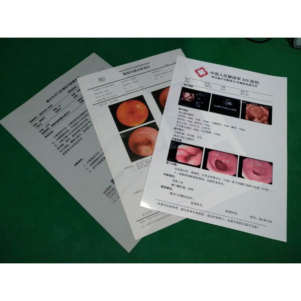 125 ЛЮБИМЦА x Рэй фильма Semi микронов листов прозрачности для струйных принтеров