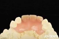 Revolucione su práctica dental con productos ligeros y diversos