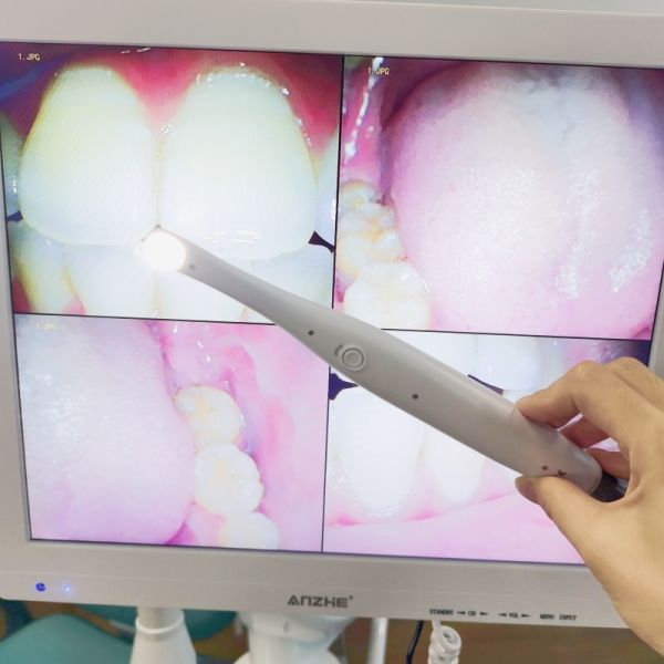 Wifi все в одном оральной камеры с громкоговорителем LCD экран стоматологической оральной камеры сканер