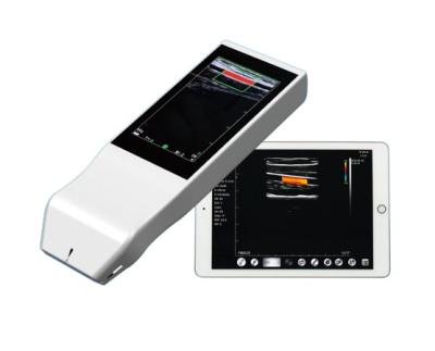 Wireless Linear Array Ultrasound Probe Handheld Wifi Ultrasound Scanner Price for Sale