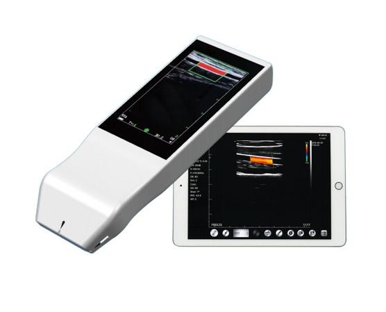 Wireless Linear Array Ultrasound Probe Handheld Wifi Ultrasound Scanner Price for Sale