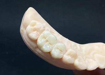 Coroa de zircônio de alta translucidez Design de aparência natural com resistência a chipping