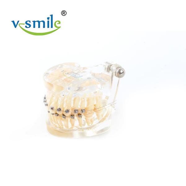Oral Orthodontics Stainless Steel Self Ligating Brackets 0.022'' 0.018''
