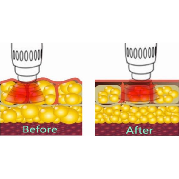 2 In 1 Pneumatic Electromagnetic Shockwave Therapy Machine Pain Relief
