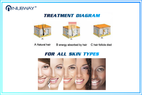 10 Laser bars  Strong Power 808nm Diode Laser Hair Removal Machine