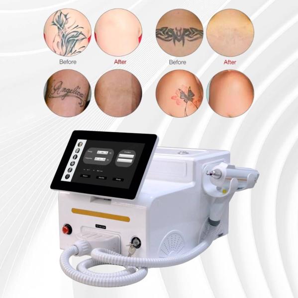 Skin Whitening Nail Fungus Laser Treatment Machine 1064nm 532nm 1320nm Wavelengths