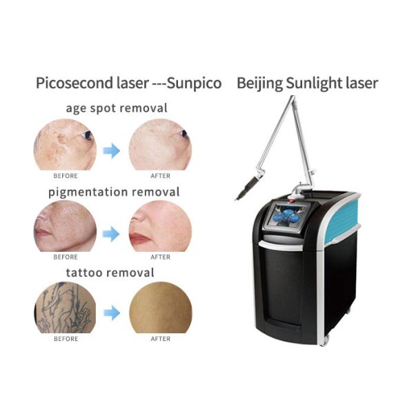 Pigments Tattoo Removal Machine , Fast Effective Laser Tattoo Removal Equipment