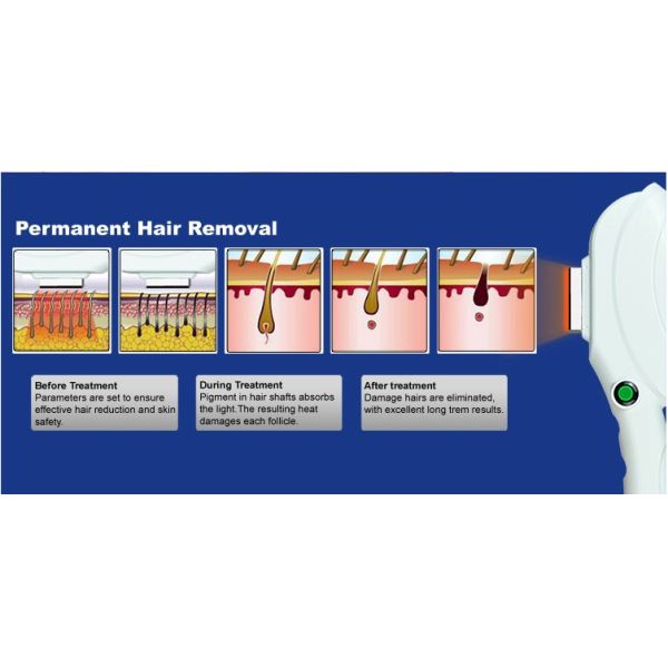 IPL SHR hair removal machine / 2 handpieces skin rejuvenation machine