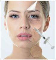 a cruz de 1ml 1.1ml ligou enchimentos cutâneos ácidos hialurónicos para o mordente de Midface do nariz