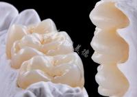 Couronne dentaire en zirconium de haute résistance pour le remplacement d'une ou de plusieurs dents