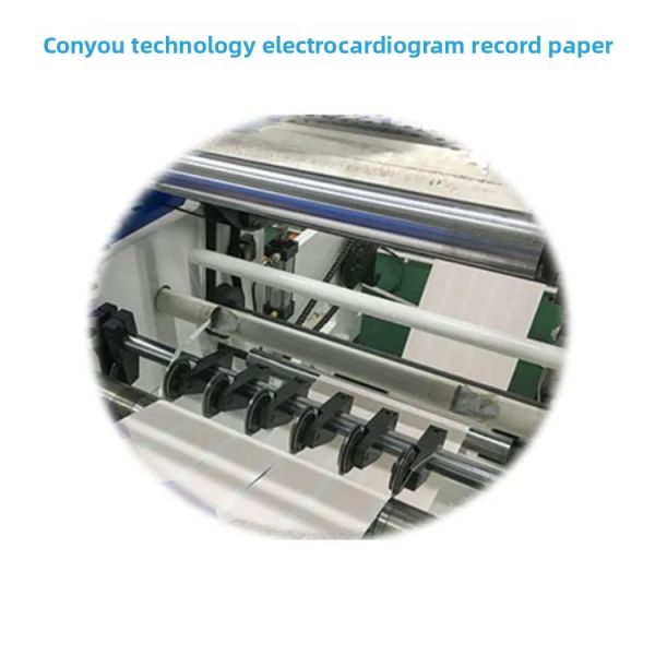 Kangeryyou 50mm*20mm Thermal Printing Paper Medical Consumables for ECG Recording