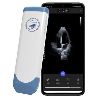 5MHz Pocket Handheld Ultrasound Scanner For Mobile Cardiac Diagnosis