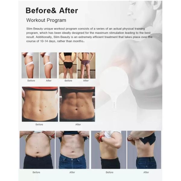 Price Mini Emslim EMS Body Sculpting The High-Performance Muscle Building Equipment For Home Use