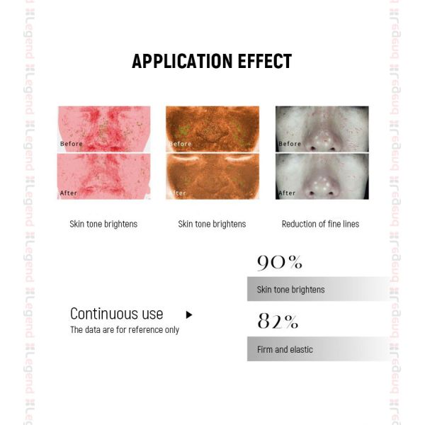 Newest Hot Sale Professional Skin Auto MD Electroporation Needle System Microneedling Derma Pen