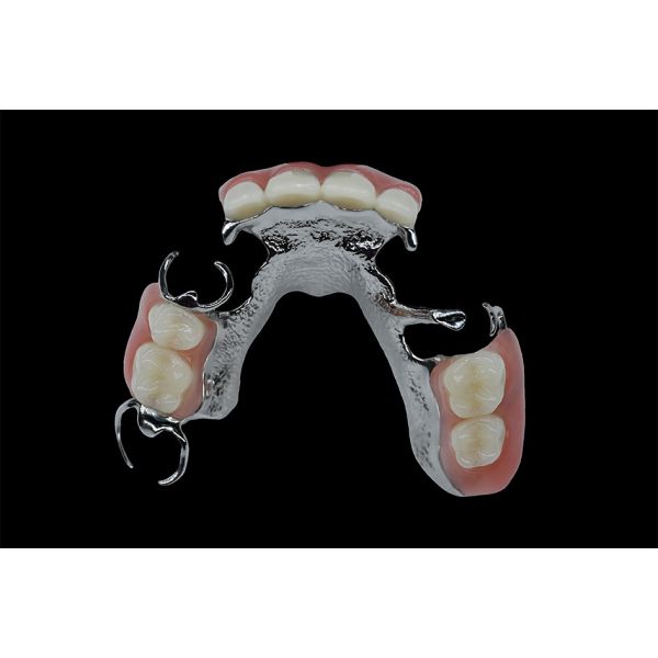 Customizable Removable Dentures Titanium Framework Dental Metal Framework