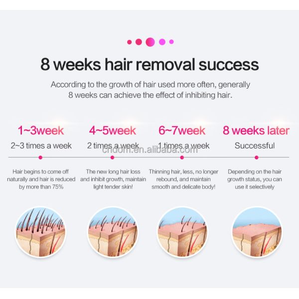 Experience Professional Results at Home with Our OEM Logo IPL Hair Removal Device
