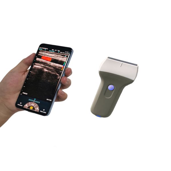 Зонд IPhone 7.5MHz USB Wifi блока развертки ультразвука кармана Doppler цвета линейное