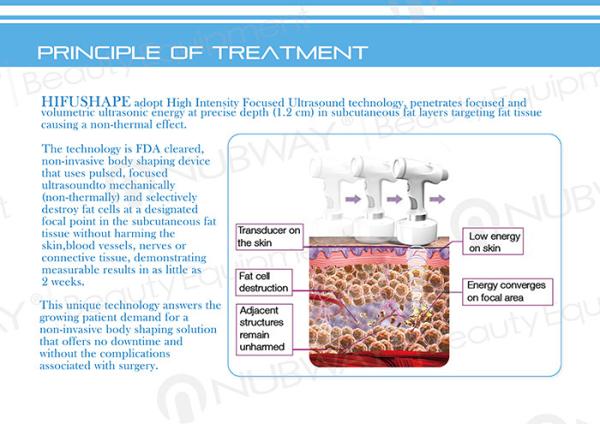 Advanced VERTICAL ultrasound machine/hifu body slimming machine/body slimming hifu