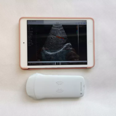 GYN Ultrasound Instruments Wireless Portable Clinical Probe Analytical Instruments Mobile Ultrasound Machine