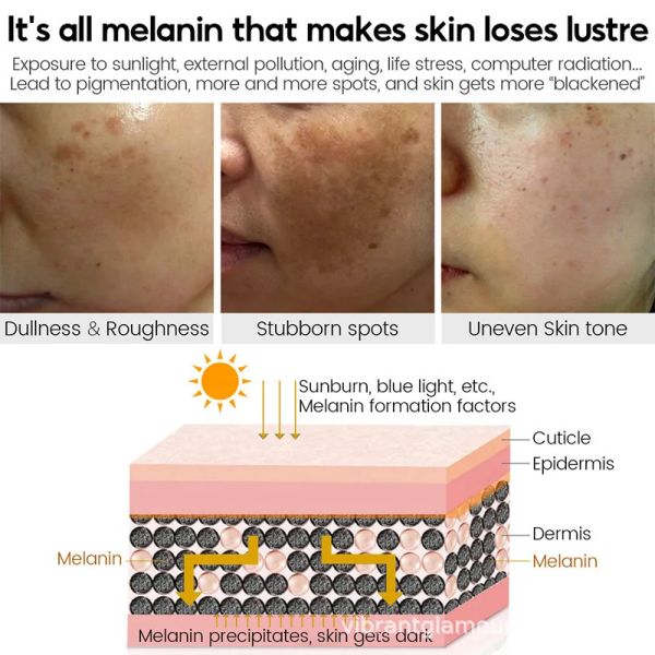 Крем для лица Увлажняющий крем Антивозрастный акне Витамин С Крем для удаления черных пятен