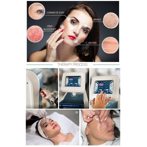 Jetpeel Facual Pressure Injecting Hydro Skin Oxgyen Injection Machine For Sale Myjet Jetpro Jet Peelingg Glowing skin