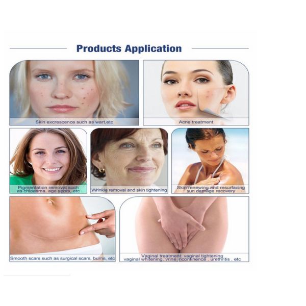 Puffiness машины 10600nm лазера портативного СО2 двуокиси 60W частичный анти-