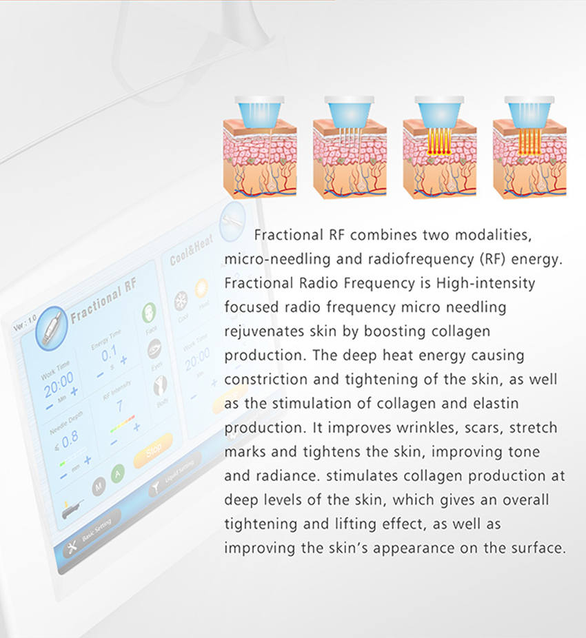 машина частичной RF глубокой жары 4 рук красоты Microneedling лицевая