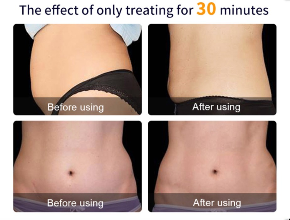 Slimming 4 Handle Desktop EMS Sculpting Machine Fat Loss Body Shaping