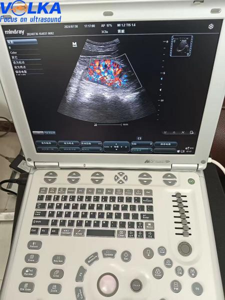 Sistema portátil de ultra-som original Mindray M7
