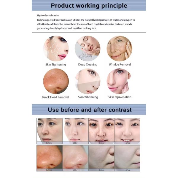 Supply Oxygen Jet Peel Skin Rejuvenation Machine Hydra Dermabrasion Machine