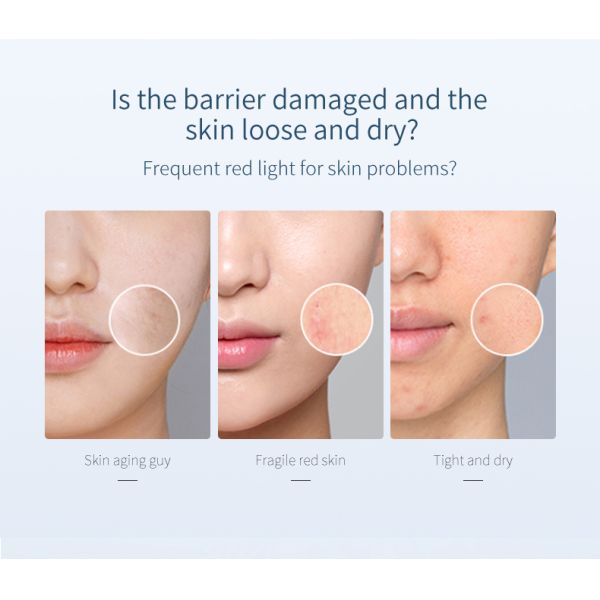 Коллагена тонера пептида меди Unscented вызревание лицевого анти-