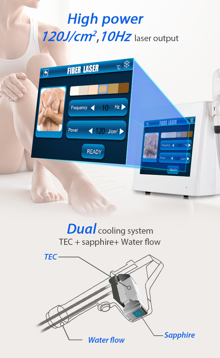 Лазер прочное Handpiece и длинная продолжительность жизни волокна прибора лазера удаления волос