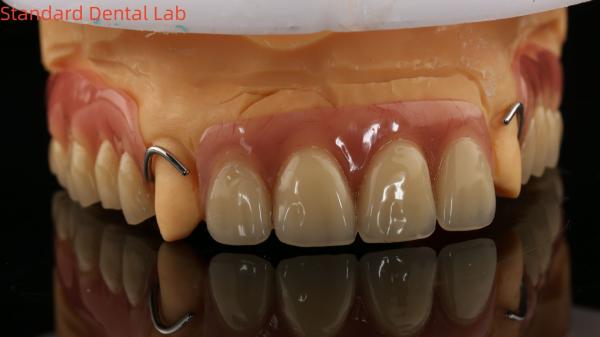 Dentures en acrylique complète ISO avec des dents d'or jaune