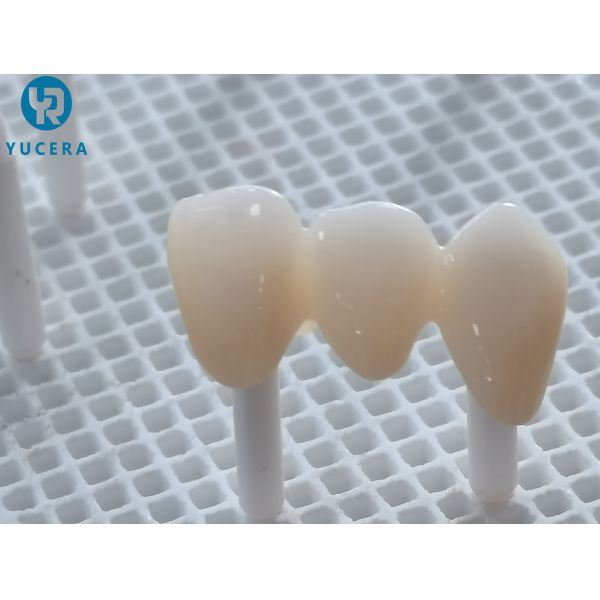 Разнослоистый зубоврачебный пробел Zirconia 1200HV для оборудований лаборатории Рональд