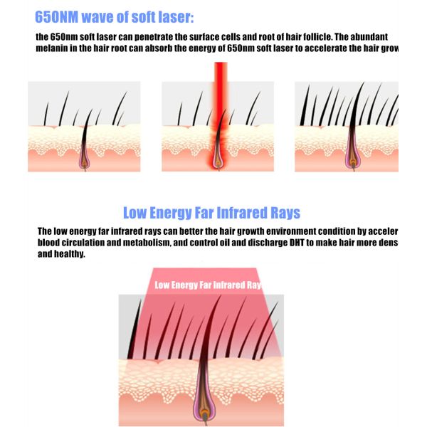 Домашний шлем роста волос лазера пользы для волос теряет обработку