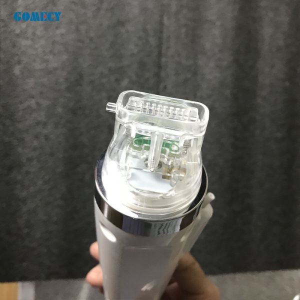 300W отсутствие удаления шрама угорь машины Tixel Rf облучением частичного
