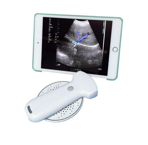 Medical 192 Element Wireless Handheld Color Doppler Ultrasound Probe Built-in Lithium Battery