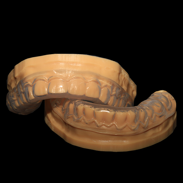 Digital Dental Lab | Clear Soft Night Guard Occlusal Splint Breathability Heavy Duty Protection
