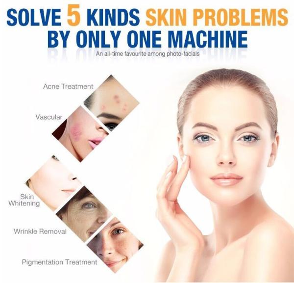 Máquina da remoção do cabelo do laser de SHR IPL