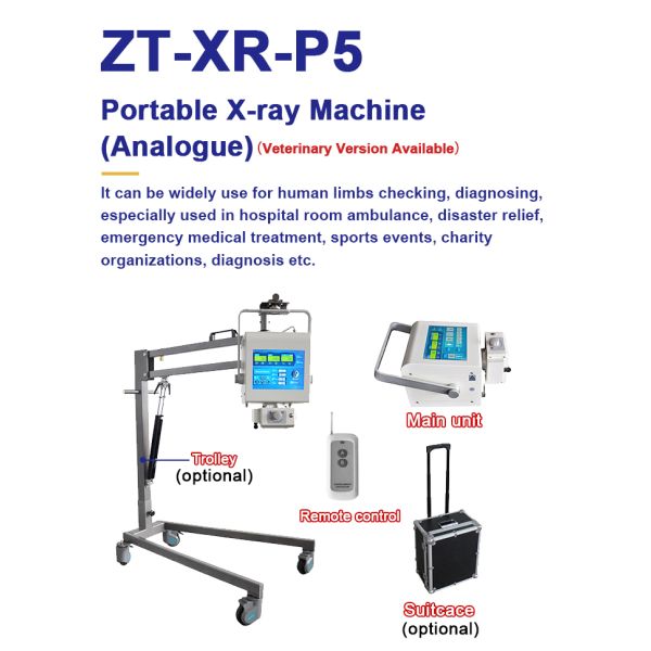 Мобильный портативный экран рентгенографии оборудования цифров кс Рэй диагноз 100мА ЛКД