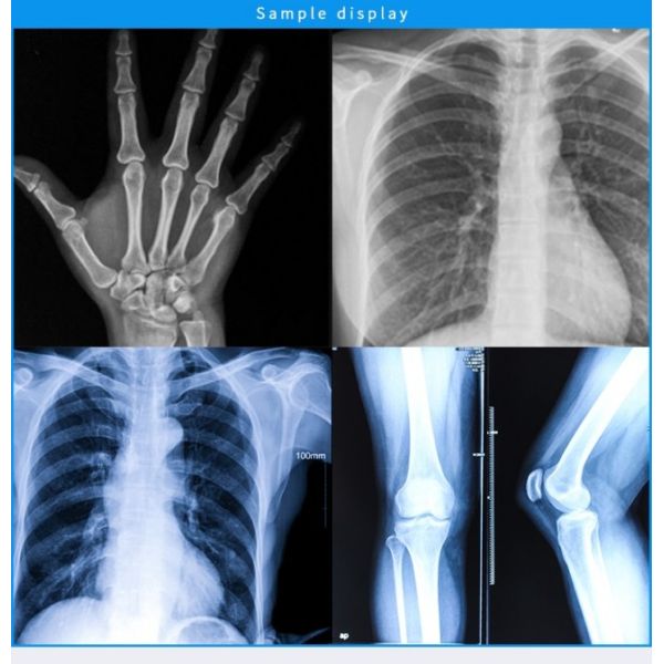 Быстрые сухие чернила струйного принтера Ix6780 6880 6580 чернила Ip7280 G1810 G1800 Ipf510 Mp5670 канона